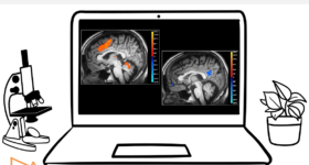 Alievo impact brain FR Photo de deux cerveaux: Un avec 2 aires oranges illuminées et un autre avec une aire bleue illuminée